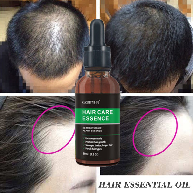 Hair Growth Oil GZBITYHN | Oem Hair Care Essential Oil forHair Treatment