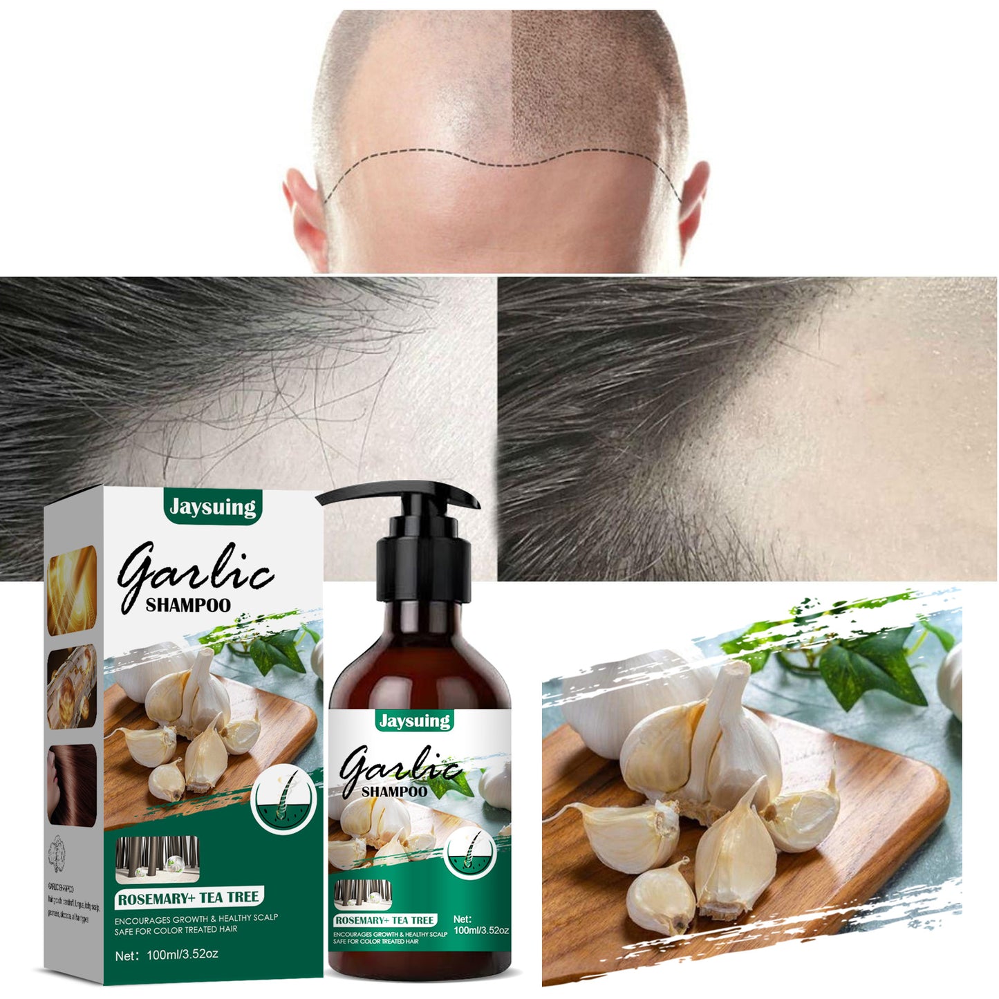 Garlic Hair Shampoo JAYSUING, 100ml Anti Itching Anti Dandruff Shampoo, Hair Growth Shampoo Hair Care