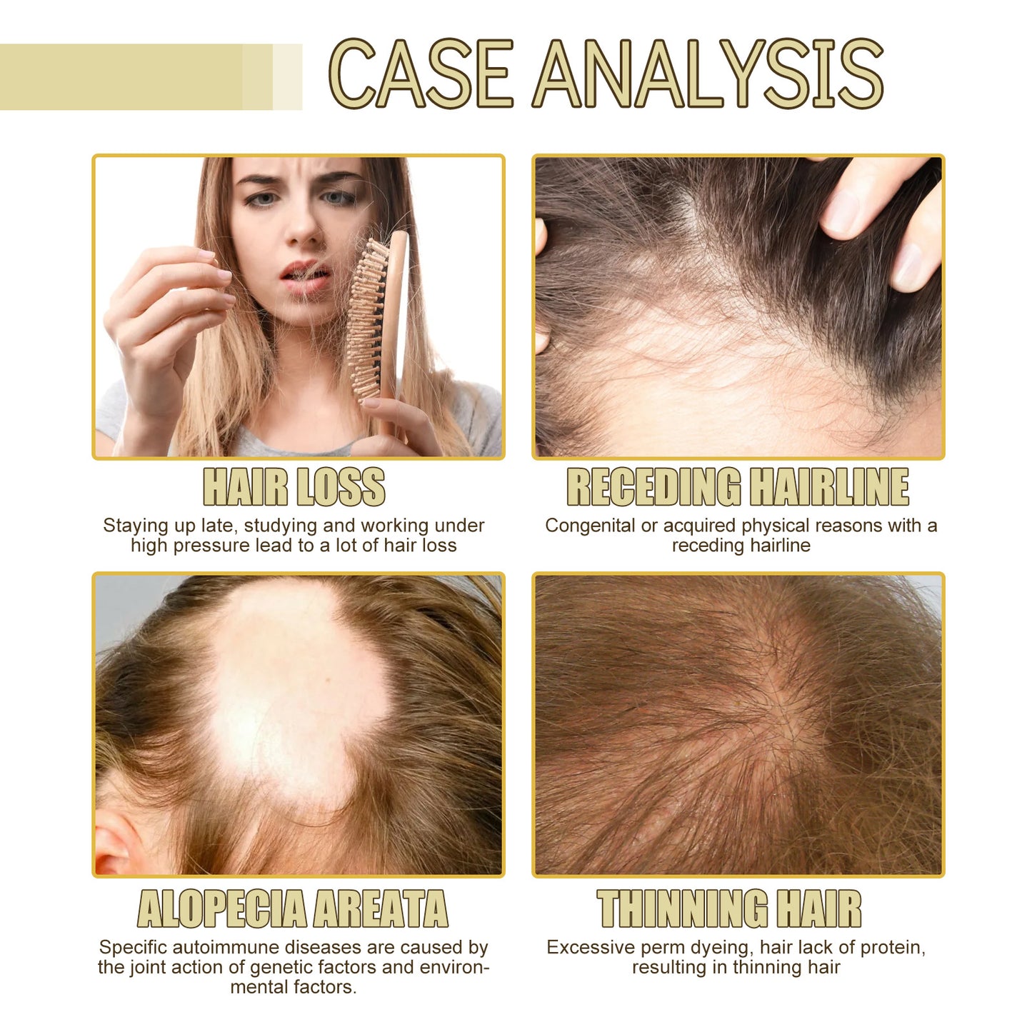 Rosemary Dense Hair Essential Oil Repair Damage Anti-drop Soft